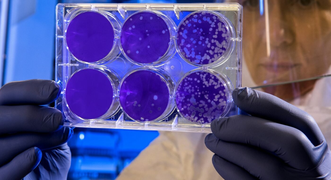Un biorépertoire brésilien pourrait aider à personnaliser la prévention du cancer dans le système public de santé