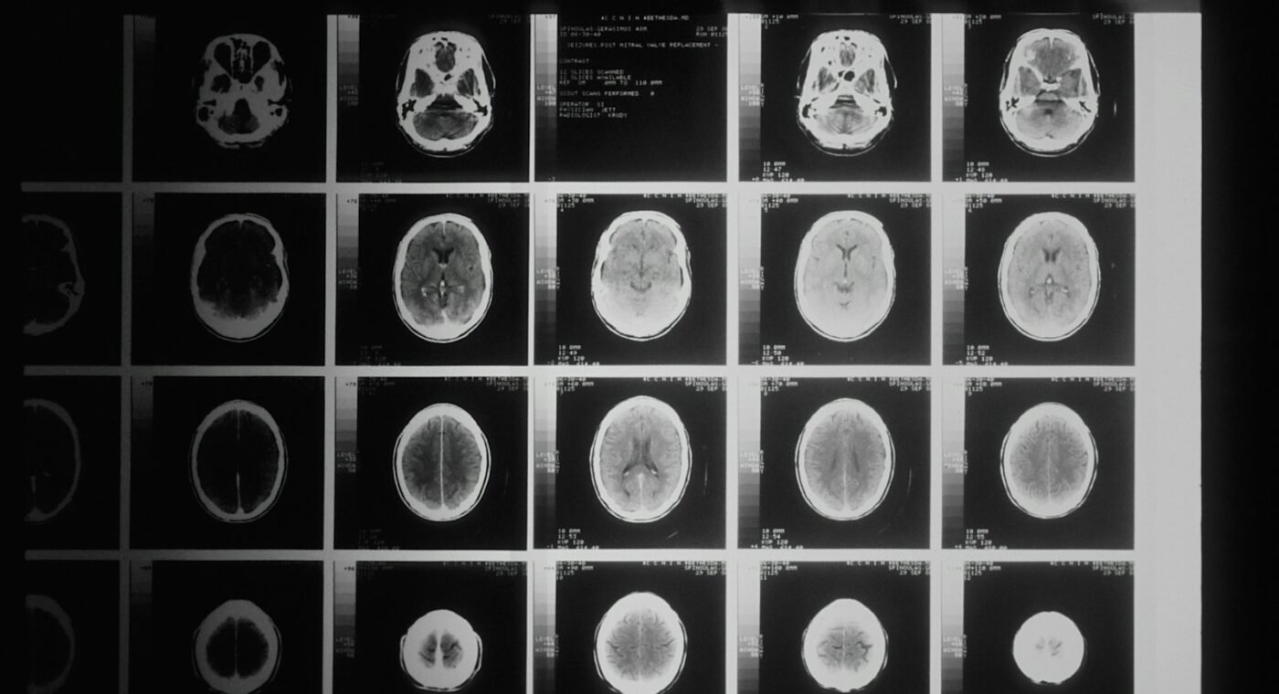 IIT Madras lança missão para mapear em 3D mais de 100 cérebros humanos, célula a célula