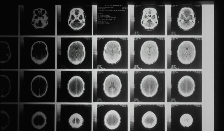IIT Madras launches mission to map more than 100 human brains in 3D, cell by cell