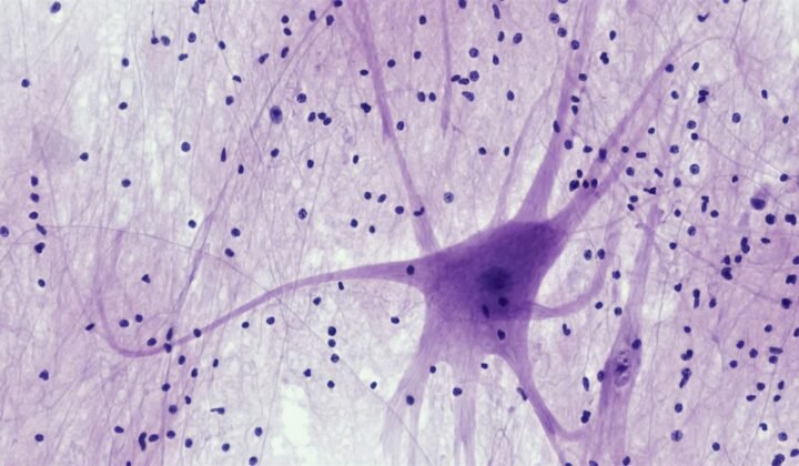 Nanobodies discovered in Lisbon halt the clumping of a protein linked to Alzheimer's