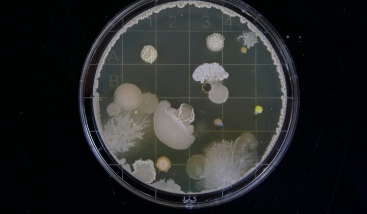 Pequena mudança numa enzima ajuda bactérias a resistir a antibióticos, descobre o CONICET