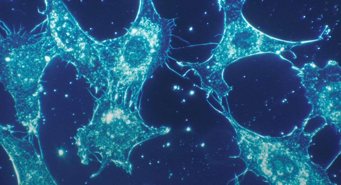 i3S discovers a "sugar code" that controls autoimmune diseases