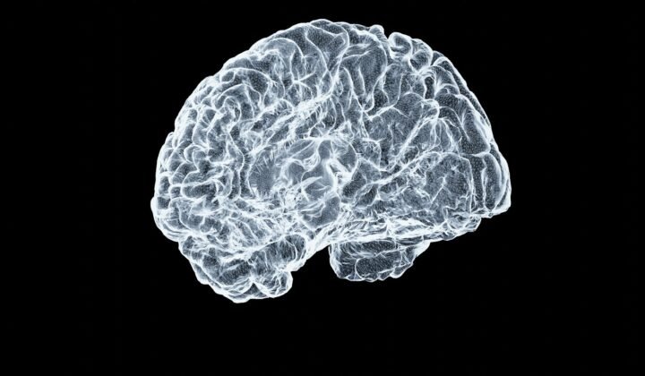 Projeto luxemburguês usa inteligência artificial para detetar sinais de Alzheimer em ressonâncias