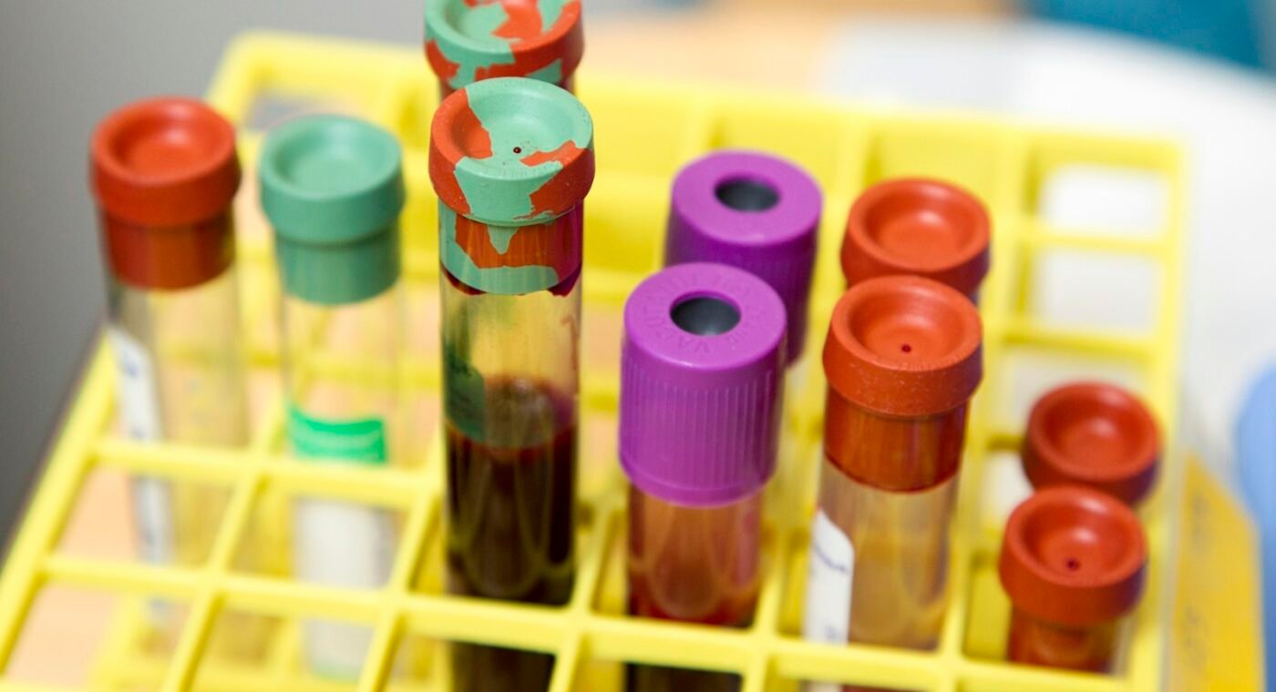 Imagem ilustrativa: Novo teste simples deteta cancro do útero sem exames dolorosos