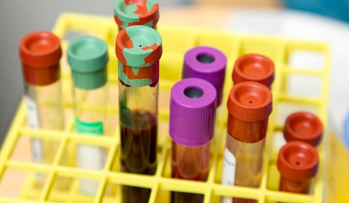Imagem ilustrativa: Novo teste simples deteta cancro do útero sem exames dolorosos