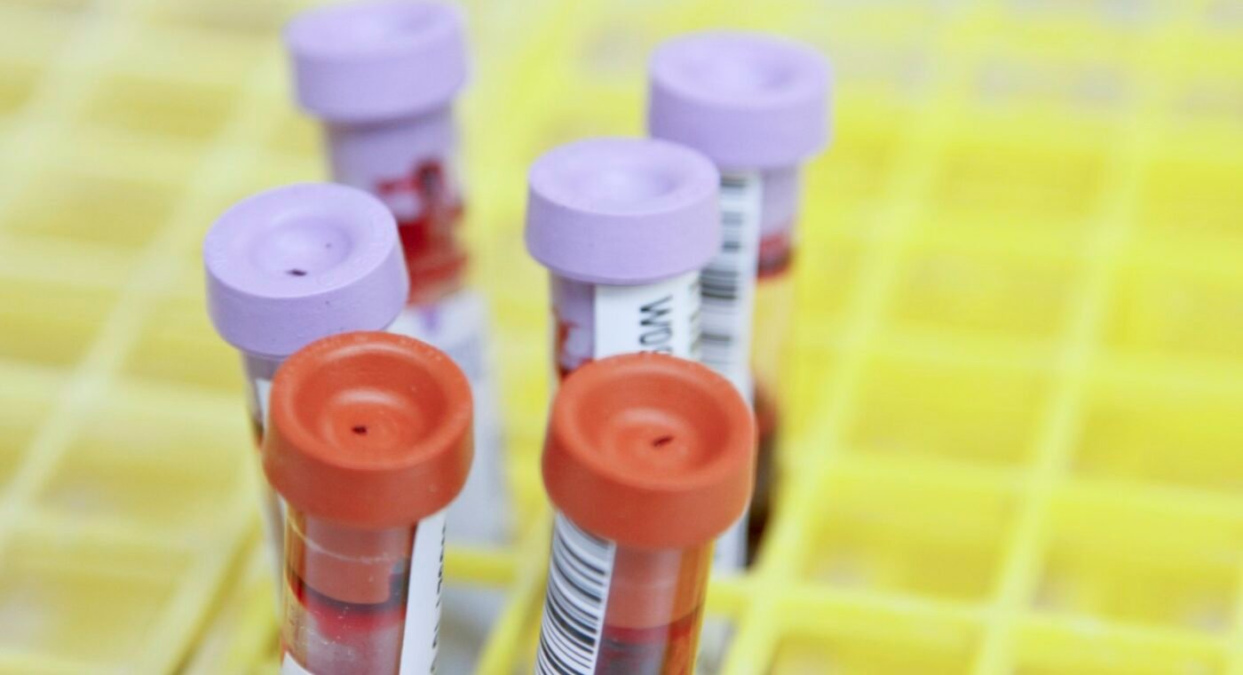 Smarter HIV drug resistance testing moves into routine care in South Africa