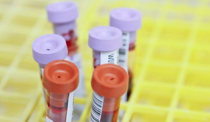 Smarter HIV drug resistance testing moves into routine care in South Africa