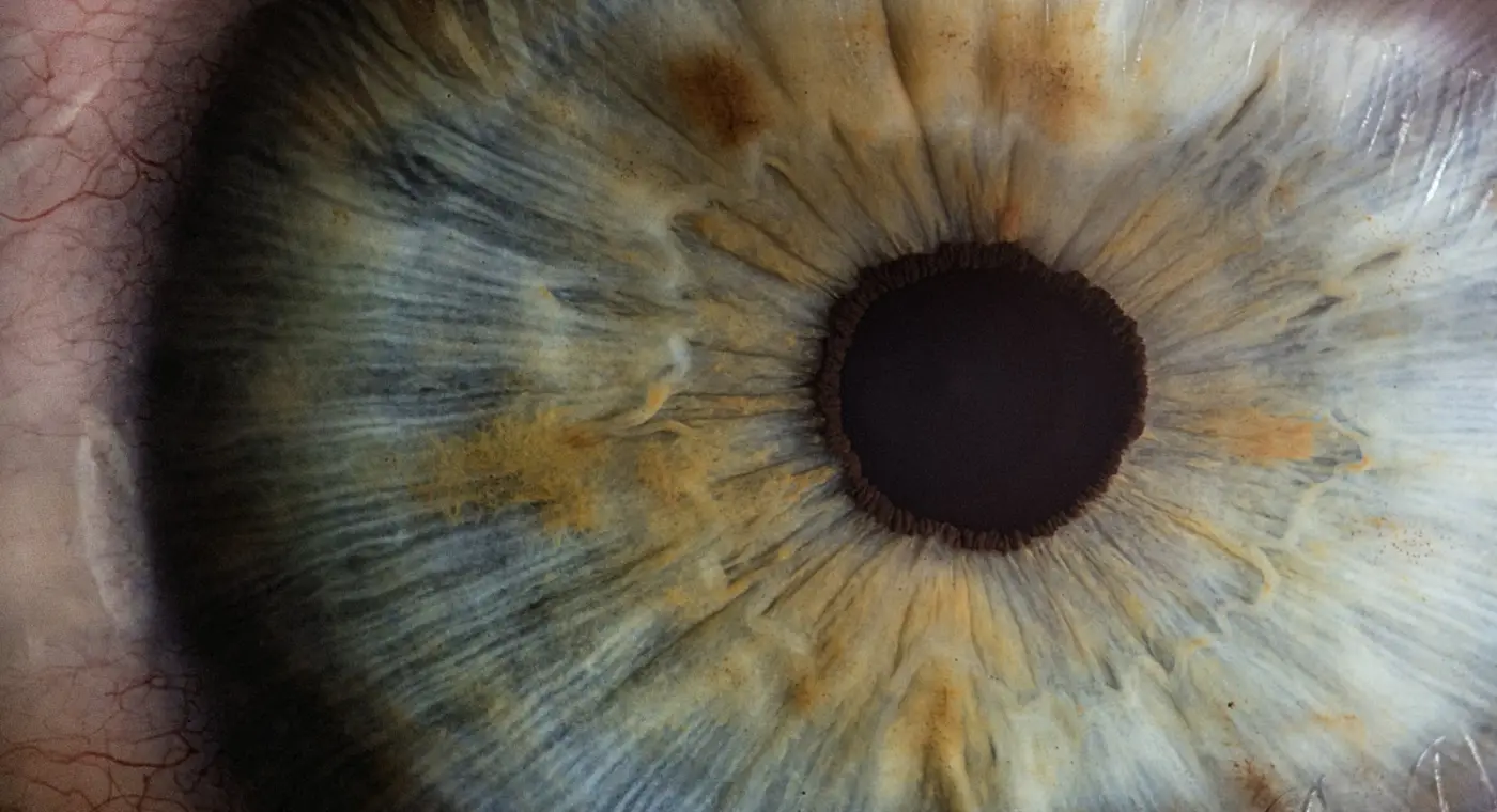 De caminhar descalço para a escola a abrir uma clínica de olhos: o percurso de um optometrista ugandês